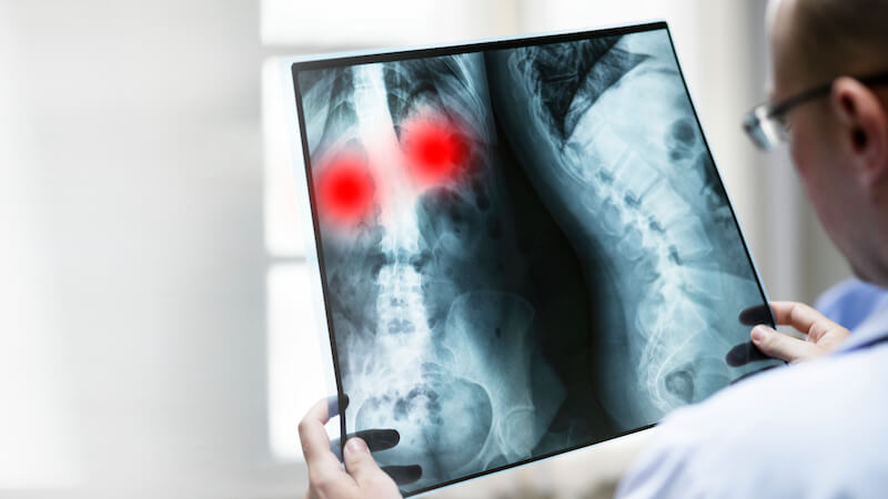 radiolog pregleda rendgenski snimak